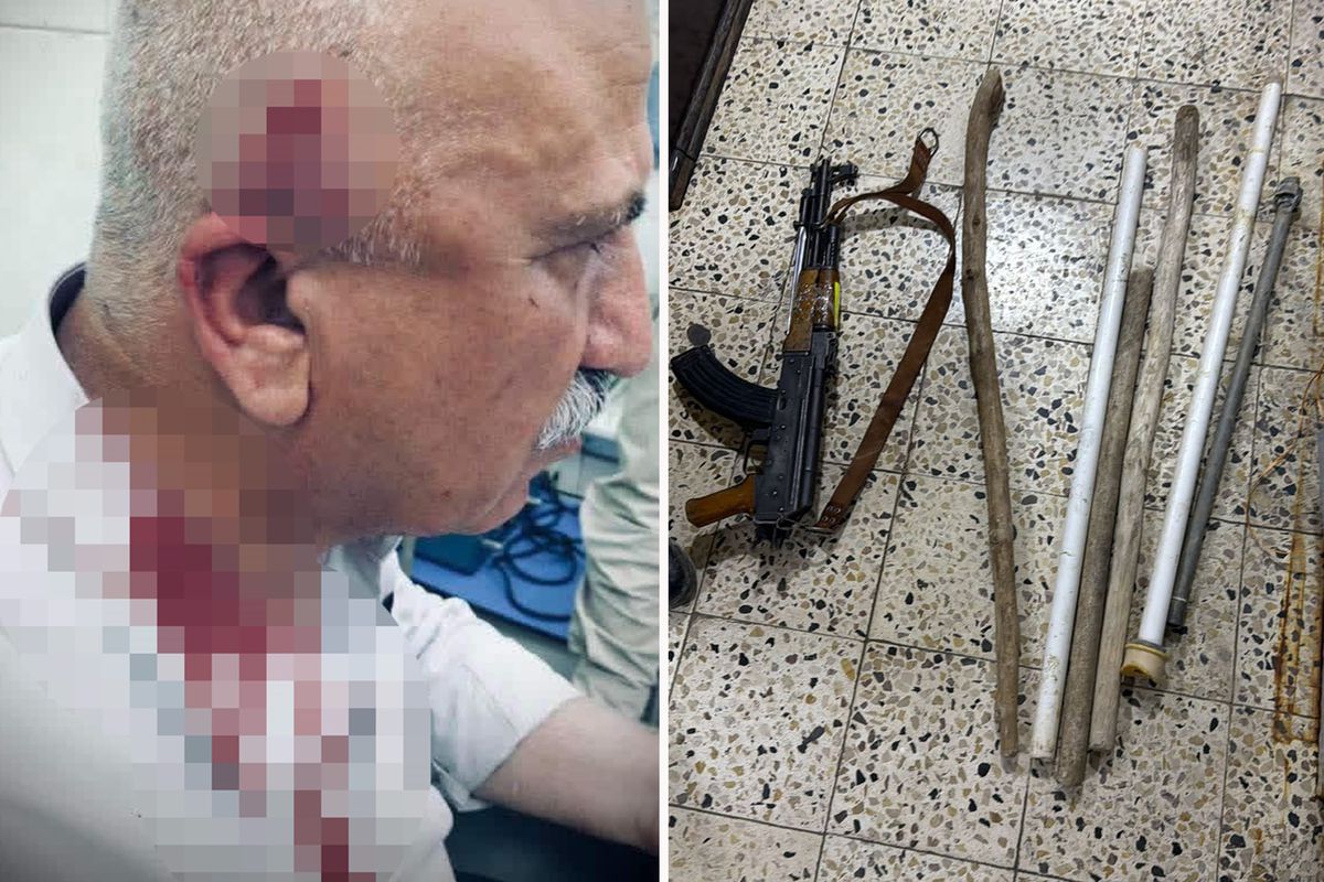 Kerkük'te kaçak yapı yıkımı sırasında kaymakama bıçaklı ve sopalı saldırı